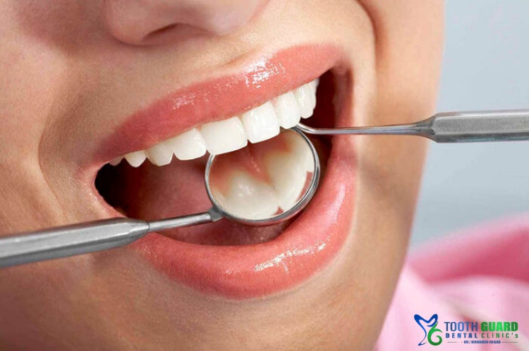 علاج التهاب عصب الضرس في مصر